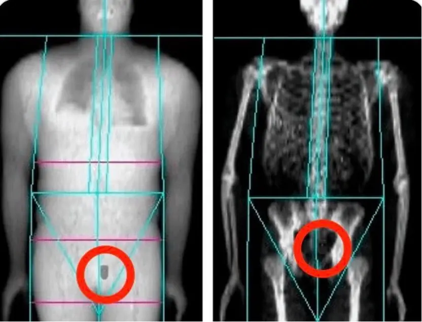 Terra前创始人Do Kwon引渡回美受审,听证会上拒不认罪